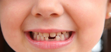 Preguntas frecuentes sobre los dientes de leche